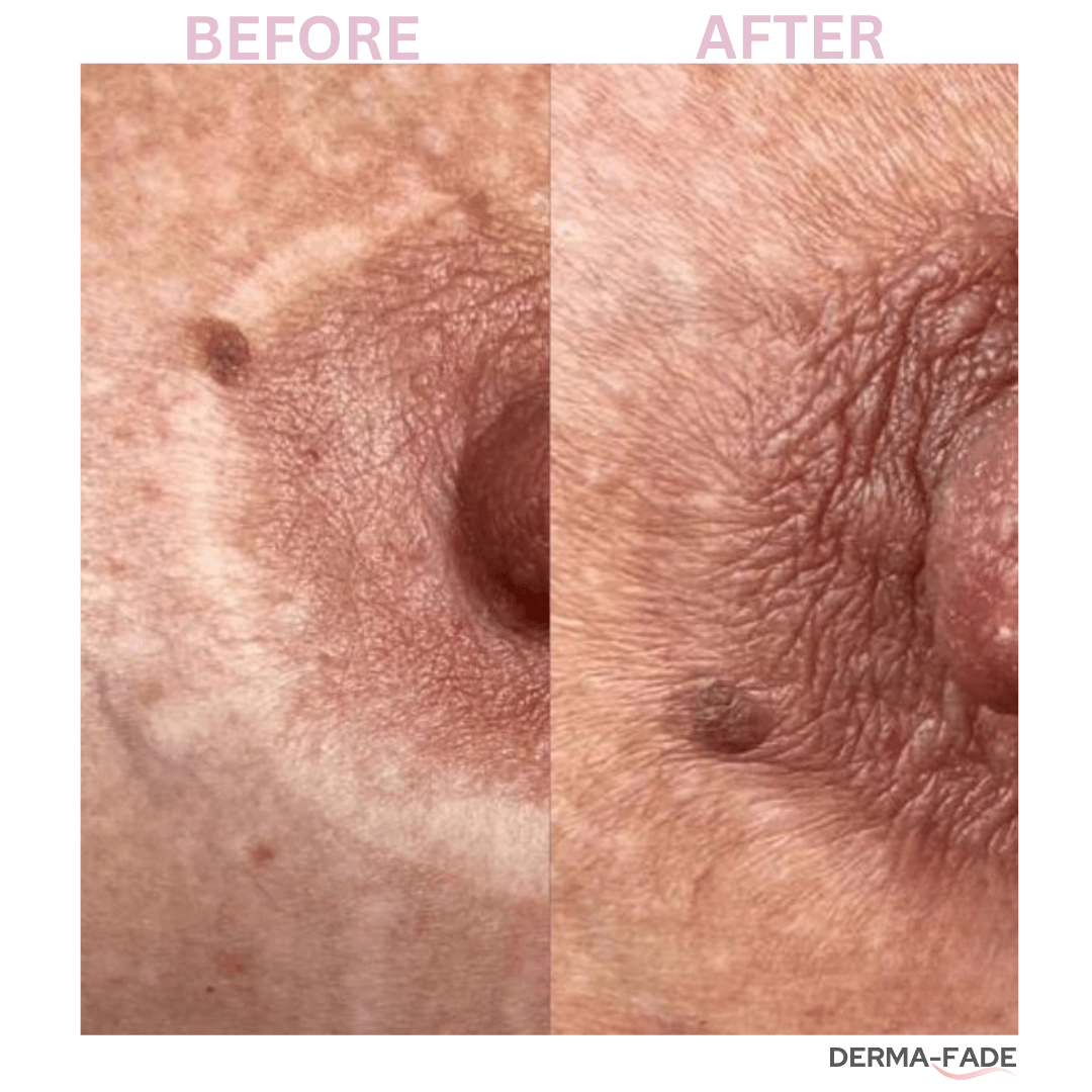 Derma - Fade - Derma - Fade