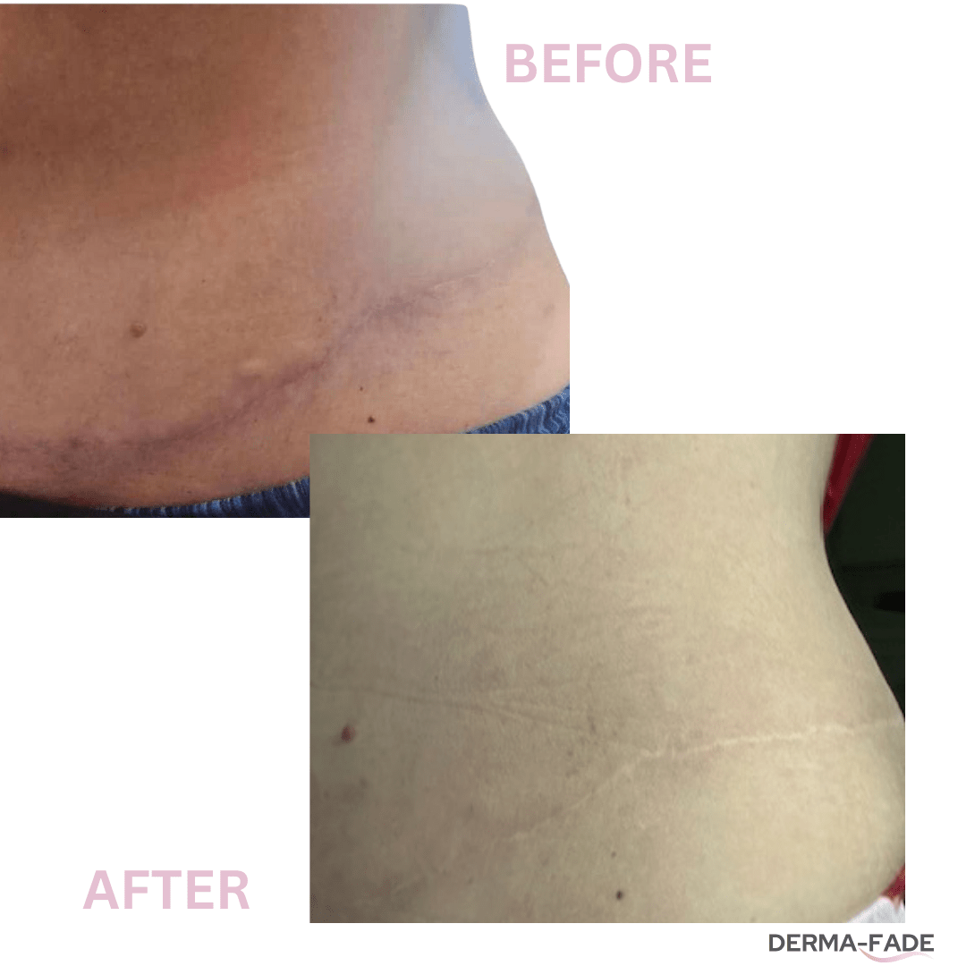 Derma - Fade - Derma - Fade