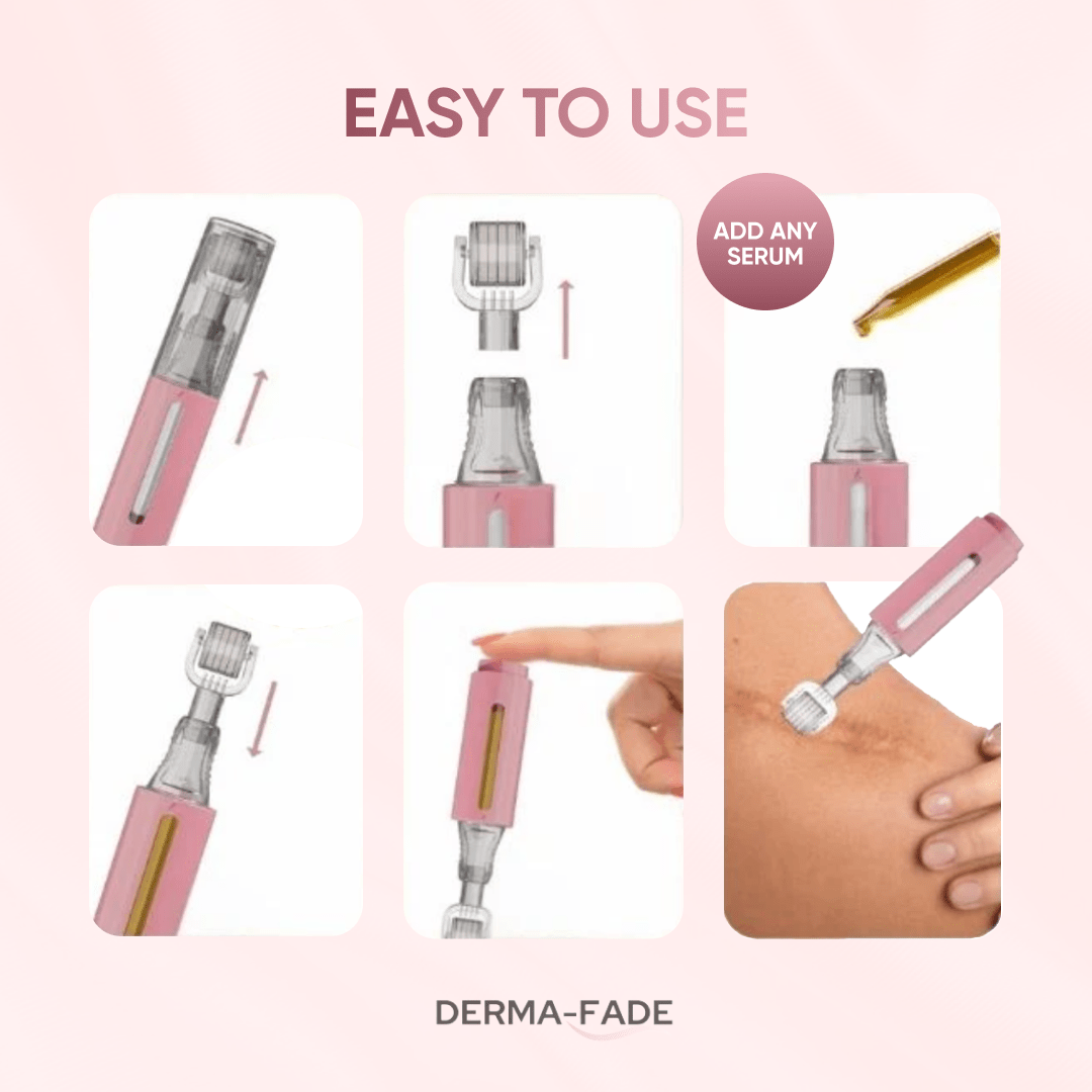 Derma - Fade™ Scar System (FREE serum limited time only) - Derma - Fade