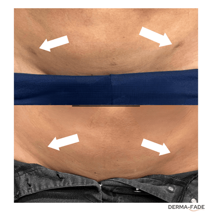 Derma - Fade - Derma - Fade