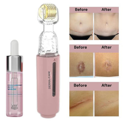 Derma - Fade - Derma - Fade