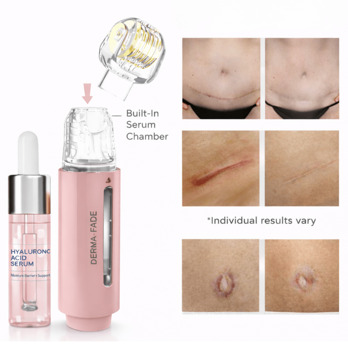 ✨ Derma - Fade Roller + Serum System™ - Derma - Fade