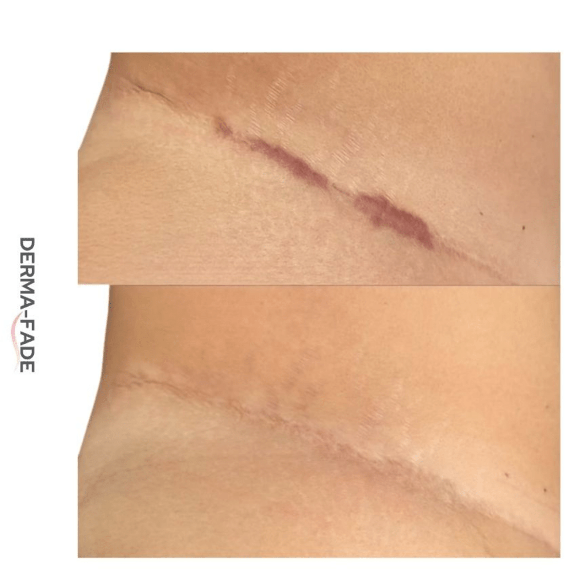 ✨ Derma - Fade Roller + Serum System™ - Derma - Fade